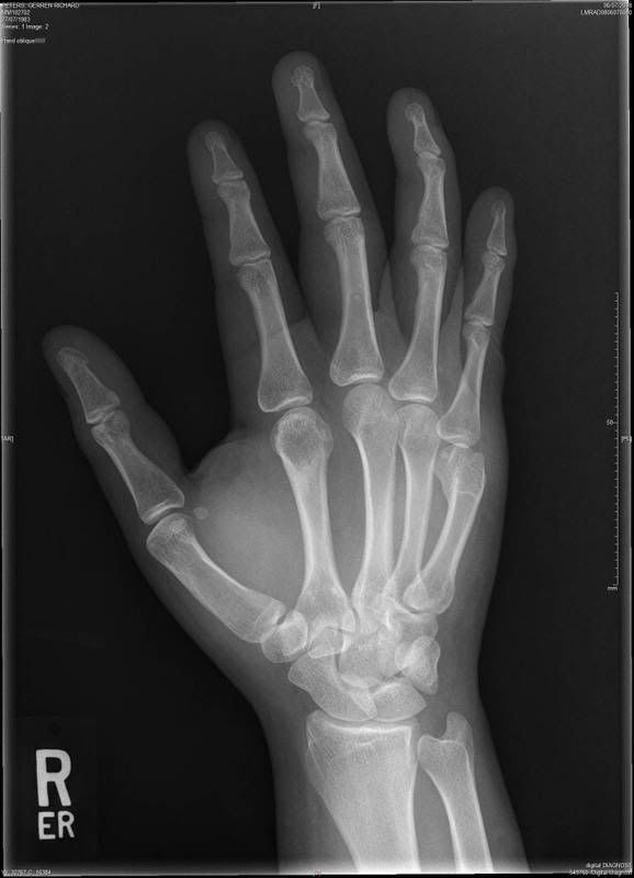 hand Pictures, Images and Photos