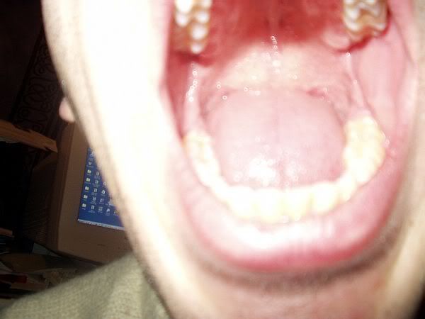 mouth.jpg
