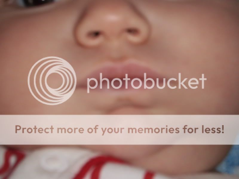 LO's lip is blue!! (pic included) BabyCenter